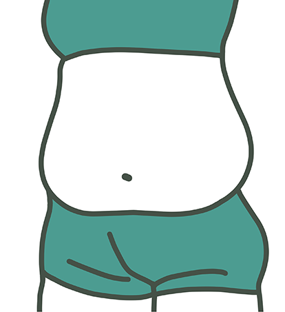 ダイエットに成功したお客様のビフォー1