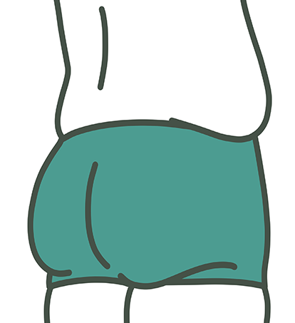 ダイエットに成功したお客様のビフォー2